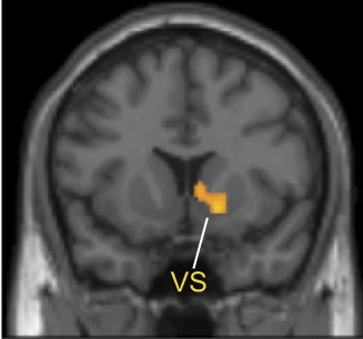 The ventral striatum